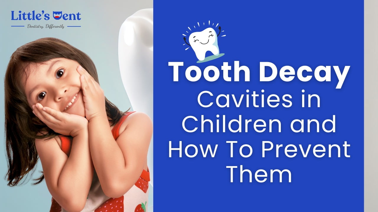 Tooth Decay In children